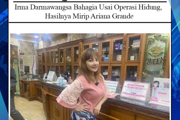 Irma Darmawangsa Bahagia Usai Operasi Hidung, Hasilnya Mirip Ariana Grande