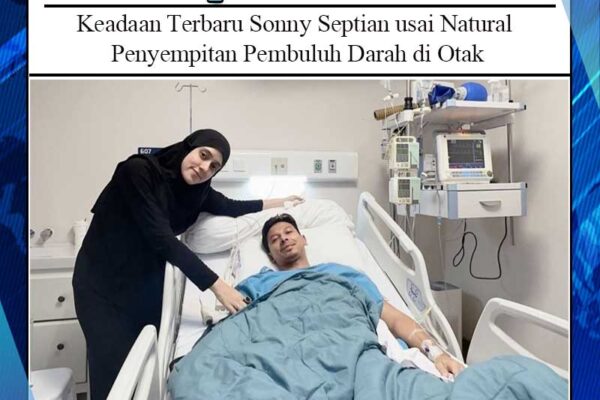 Keadaan Terbaru Sonny Septian usai Natural Penyempitan Pembuluh Darah di Otak